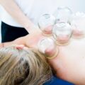 cupping-therapy-6604217_640