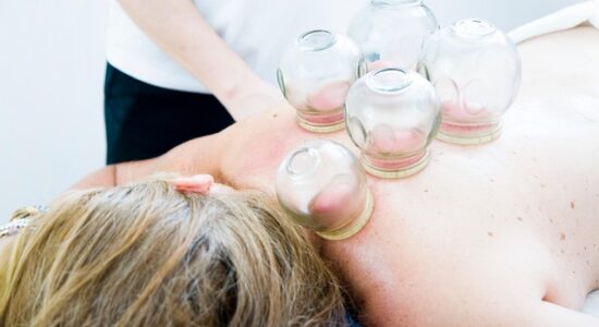 cupping-therapy-6604217_640